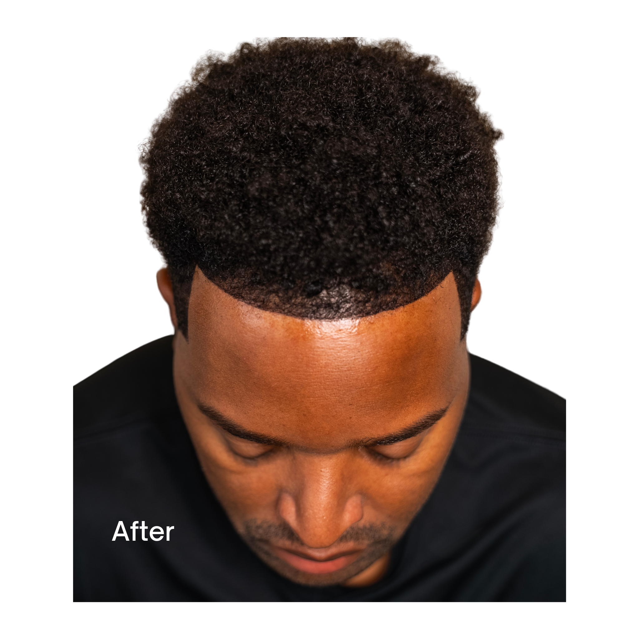 THE PRIME PACKAGE - (Front Hairline Stencils - 16 pack, Hair Fibers, Hold Spray & Applicator Pump)