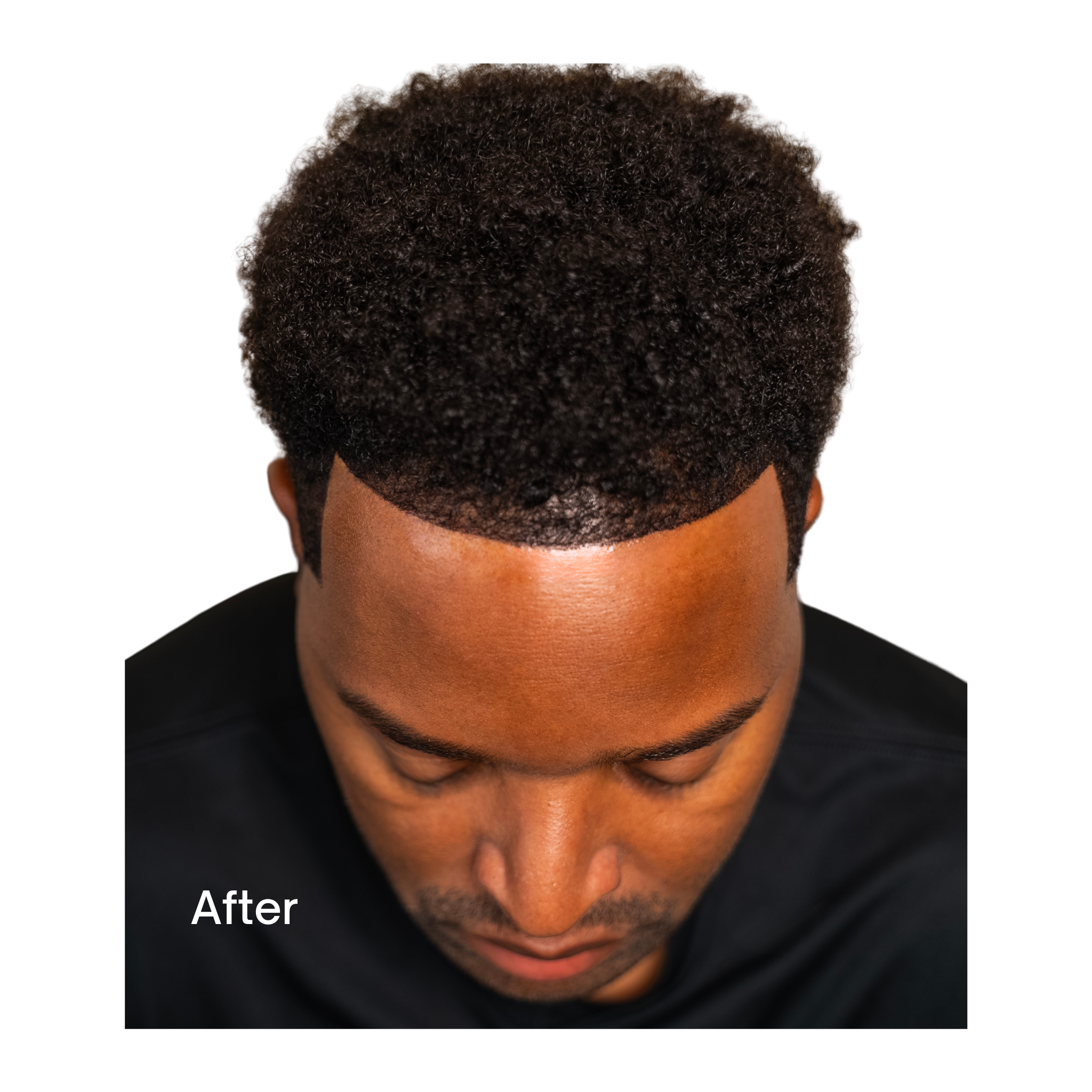 THE FYBRO™ Front Hairline Enhancement Stick-On Stencil (16 pack)